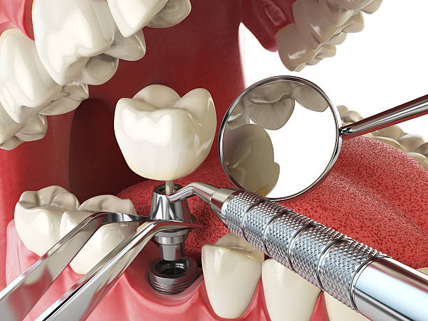 Best Urgent Tooth Repair  in Camden, SC
